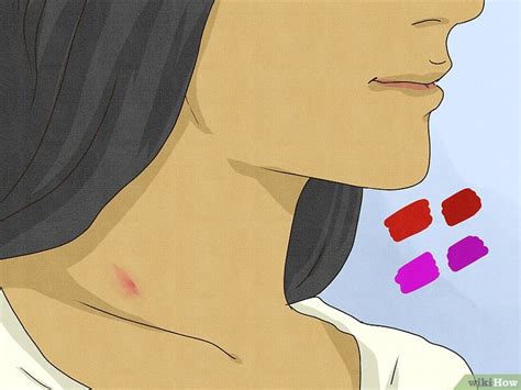 tit hickey|How to Spot a Hickey (8 Telltale Signs)